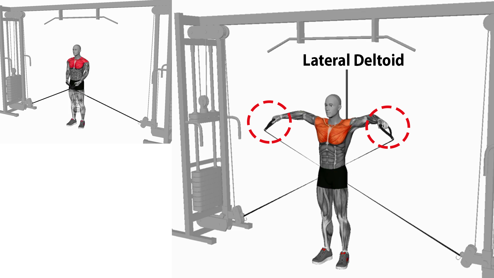 Cable-Lateral-Raise